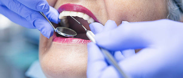 Best Chipped Tooth Repair Near Me  in Becker, MN
